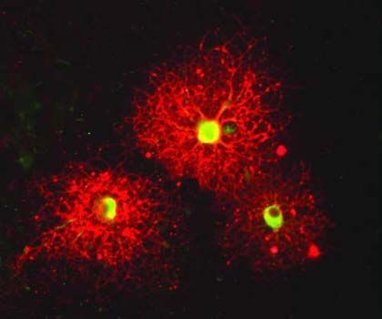 'Paisajes neuronales', Cosmocaixa Madrid