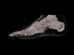Taller: 'Cuidado de los pies', fundación mejora, vitoria