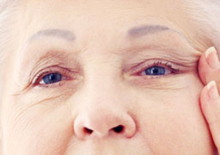¿Qué hacer en caso de sufrir un glaucoma?