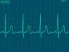 Electrocardiograma