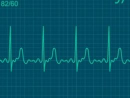 Electrocardiograma