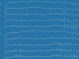 Electroencefalograma