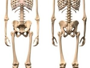 Tumores óseos malignos (cáncer de huesos)