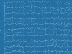 Electroencefalograma