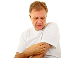 ¿Cuáles son los síntomas y tratamiento de la psoriasis?