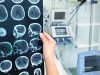 ¿Qué riesgo tengo yo de padecer Alzheimer? ¿Es hereditario?