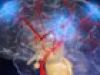 ¿Por qué se produce un derrame cerebral?