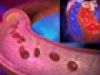 ¿Qué es la presión arterial?
