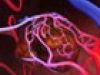 ¿Cómo se origina el cáncer de hígado?