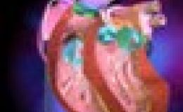 ¿Qué es la regurgitación valvular?