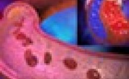¿Qué es la presión arterial?