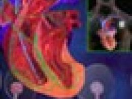 ¿Qué es la fibrilación auricular?