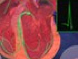 ¿Cómo se hace la prueba de Esfuerzo / ECG?