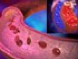 ¿Qué es la presión arterial?