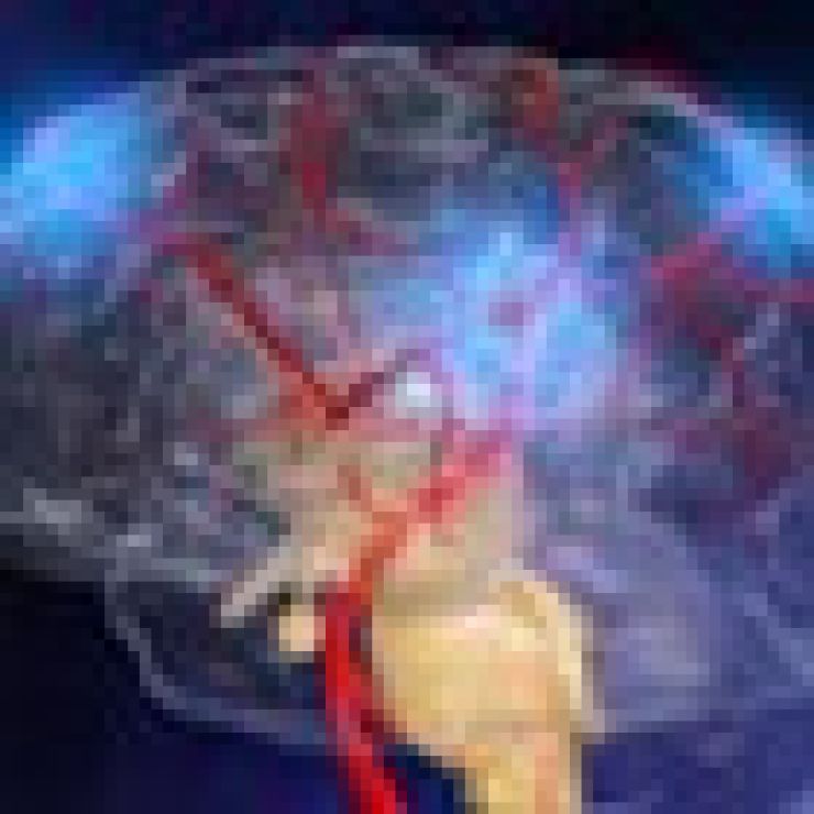 ¿Por qué se produce un derrame cerebral?