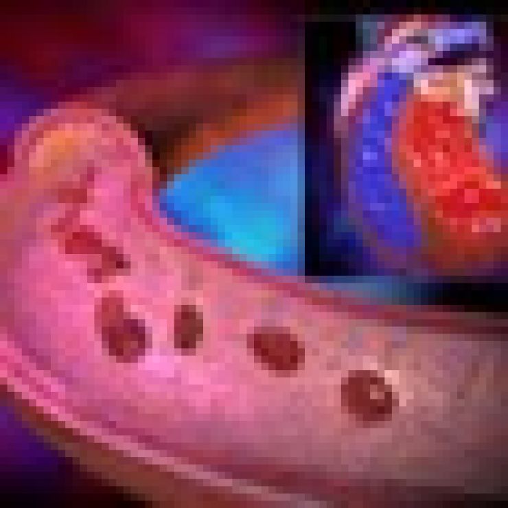 ¿Qué es la presión arterial?