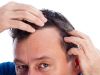El truco de la abuela contra la caída del pelo