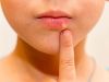 El truco de la abuela para curar un herpes en el labio
