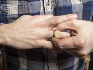 El truco de la abuela para sacar un anillo atascado en el dedo