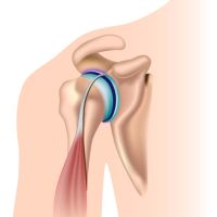 Acromion