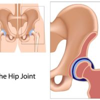 Articulación elipsoidal