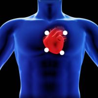 Auscultación cardiaca (zonas)