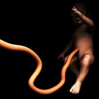 Cordón Umbilical