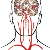 Arterias cerebrales