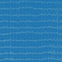 Electroencefalograma