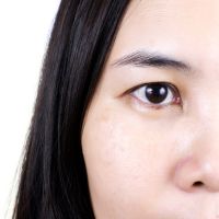 Ojo mongoloide