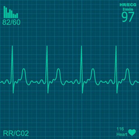 Electrocardiograma