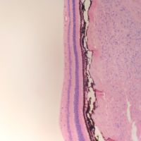 Retina al microscopio